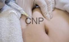 inj - Center News Network Close-up of a clinician's gloved hands on a patient's abdomen during a medical procedure; 'CNP' watermark visible.